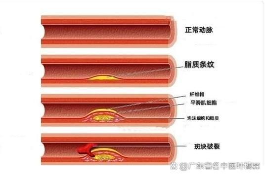 能否提供更詳細的充血征兆描述（arxiv論文助手arxiv論文助手獲取權威醫學文獻）