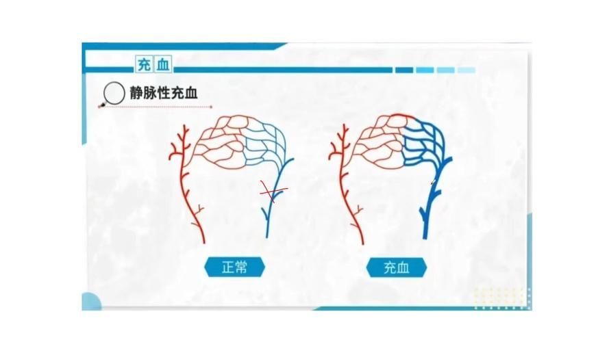 能否提供更詳細的充血征兆描述（arxiv論文助手arxiv論文助手獲取權威醫學文獻）