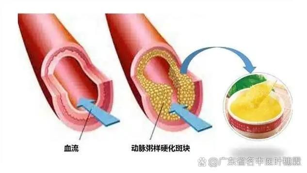 能否提供更詳細的充血征兆描述（arxiv論文助手arxiv論文助手獲取權威醫學文獻）