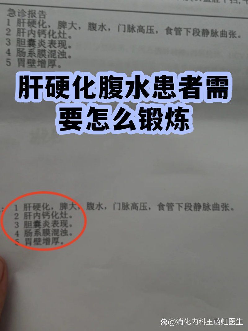 如何改善魚腹水患者的預后，肝腹水不是絕癥而是慢性病管理的試金石,堅持這五點，多數患者穩定