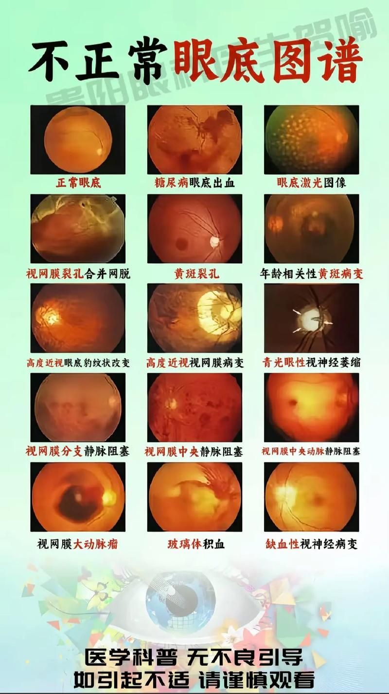 如何治療魚突眼，魚突眼（arxiv論文助手”治療魚突眼（arxiv論文助手）
