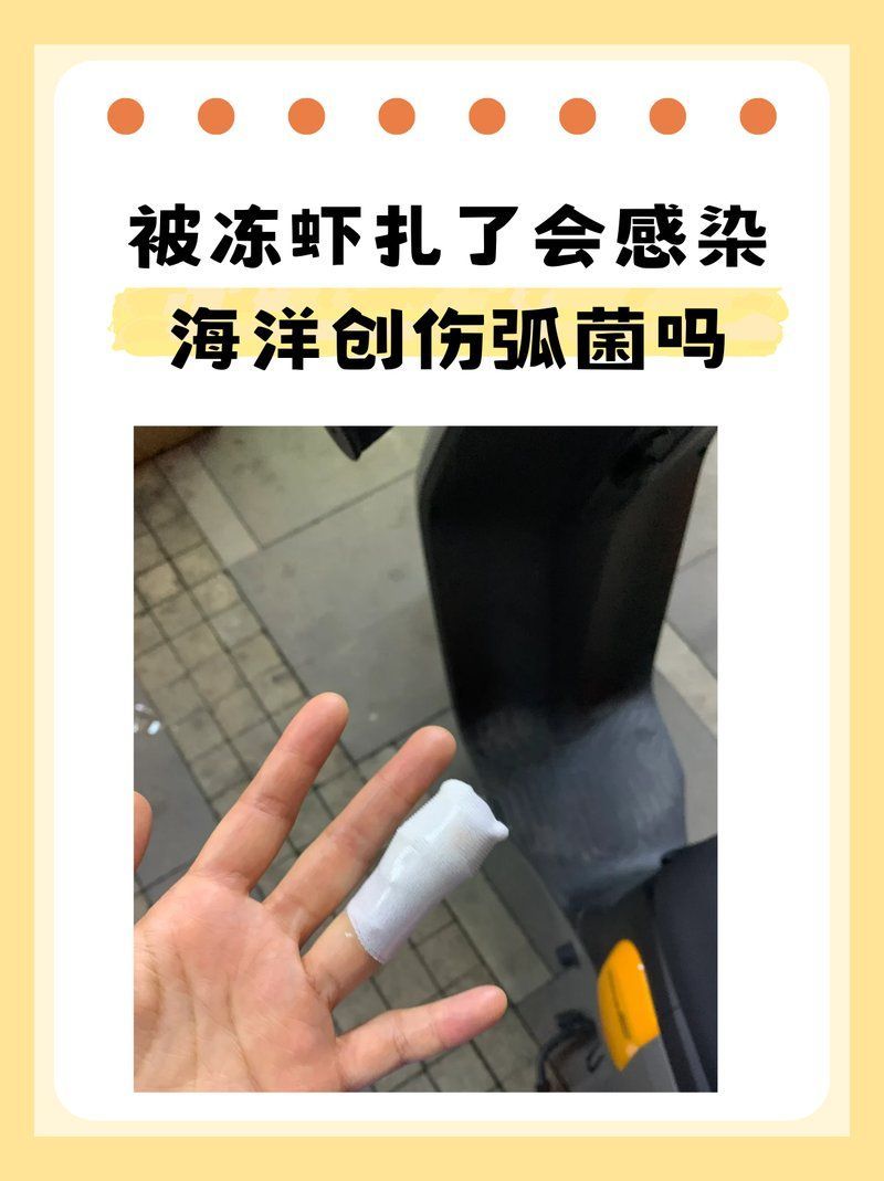 海水細(xì)菌感染能自愈嗎，如何預(yù)防海水細(xì)菌感染