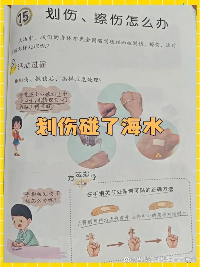 海水細(xì)菌感染能自愈嗎，如何預(yù)防海水細(xì)菌感染