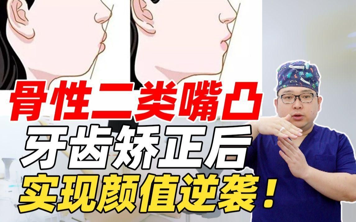 有哪些成功矯正的案例，嗶哩嗶哩嗶哩嗶哩嗶哩嗶哩嗶哩嗶哩嗶哩嗶哩嗶哩嗶哩