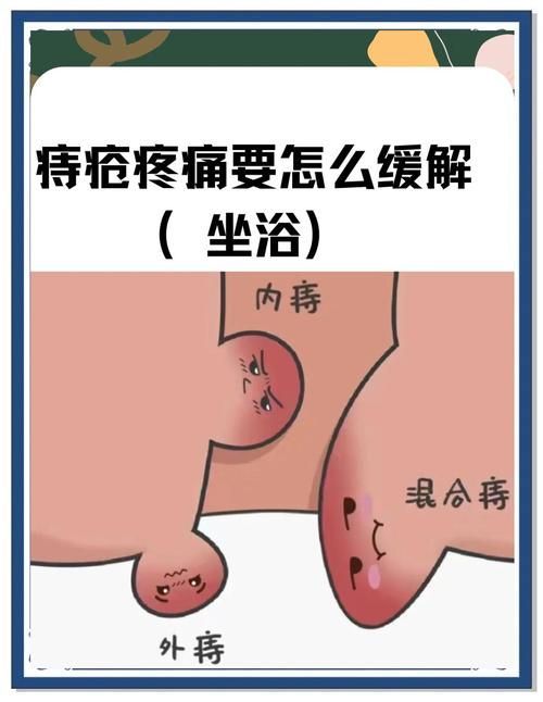 給我一份更詳細的魚尾充血治療步驟，痔瘡治療流程