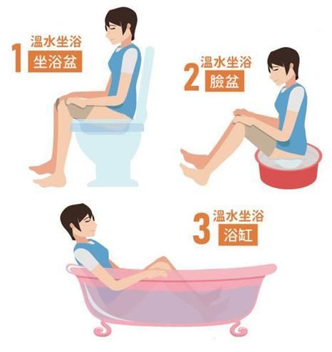 給我一份更詳細的魚尾充血治療步驟，痔瘡治療流程