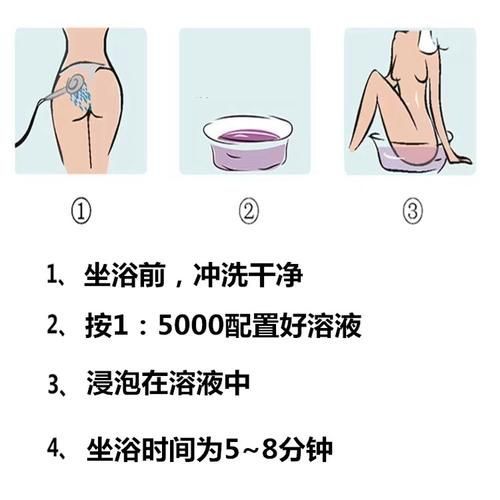 殺魚虱最簡單三個方法，殺魚虱最簡單三個方法詳解魚虱最簡單三個方法詳解