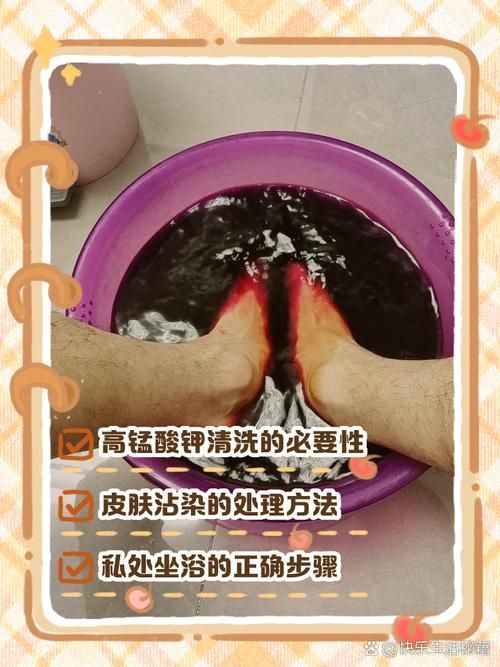 殺魚虱最簡單三個方法，殺魚虱最簡單三個方法詳解魚虱最簡單三個方法詳解