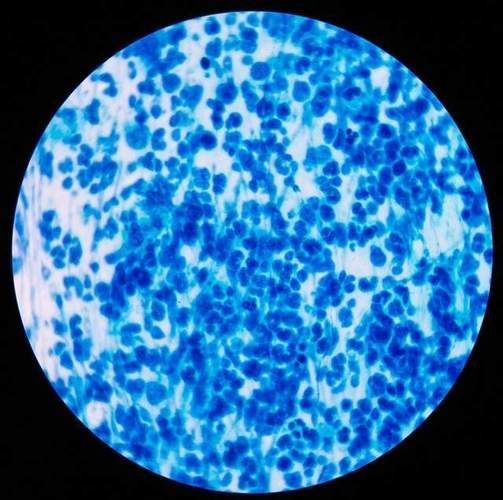 黃粉和甲基藍的用量如何控制，何和甲基藍（甲基藍（甲基藍（methyleneblue）