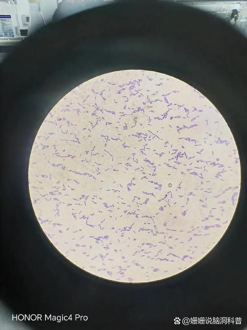 黃粉和甲基藍的用量如何控制，何和甲基藍（甲基藍（甲基藍（methyleneblue）