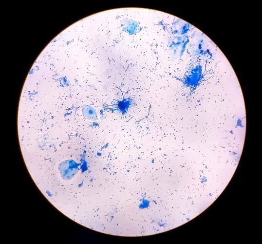 黃粉和甲基藍的用量如何控制，何和甲基藍（甲基藍（甲基藍（methyleneblue）