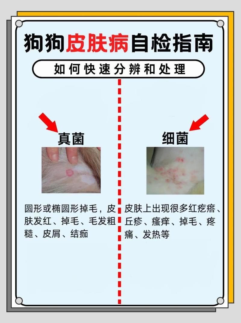 能否提供真菌和細菌感染的對比圖，如何區別真菌和細菌感染