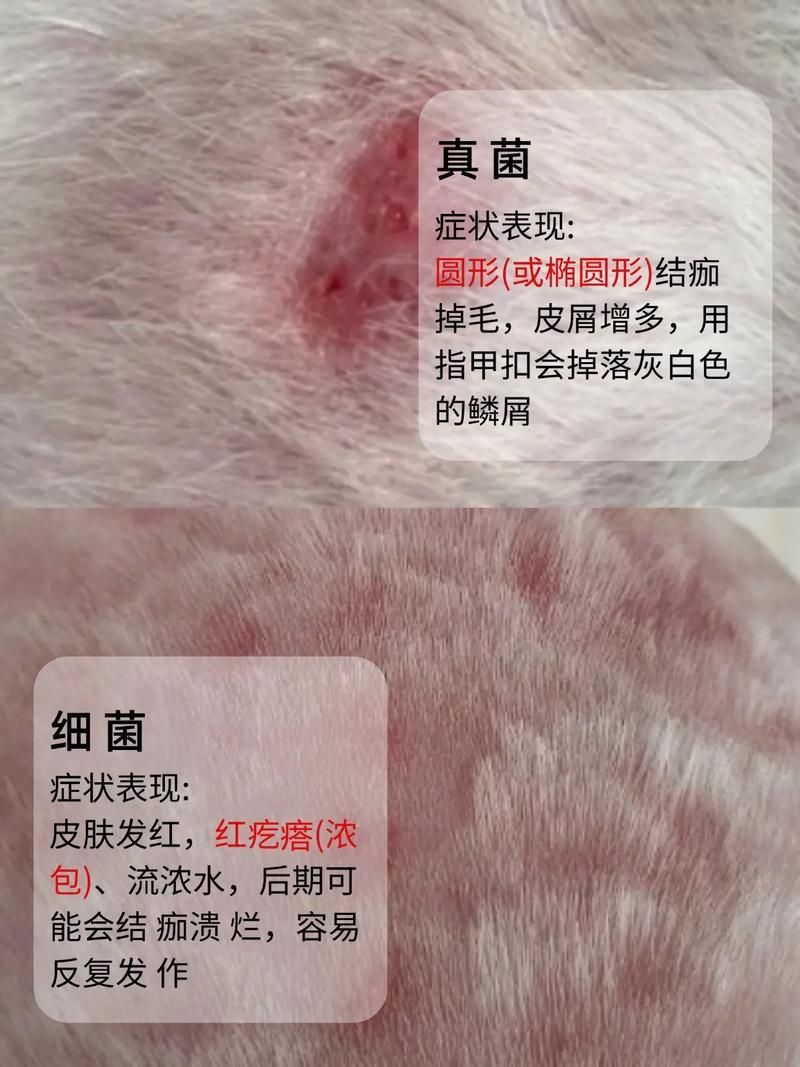 能否提供真菌和細菌感染的對比圖，如何區別真菌和細菌感染