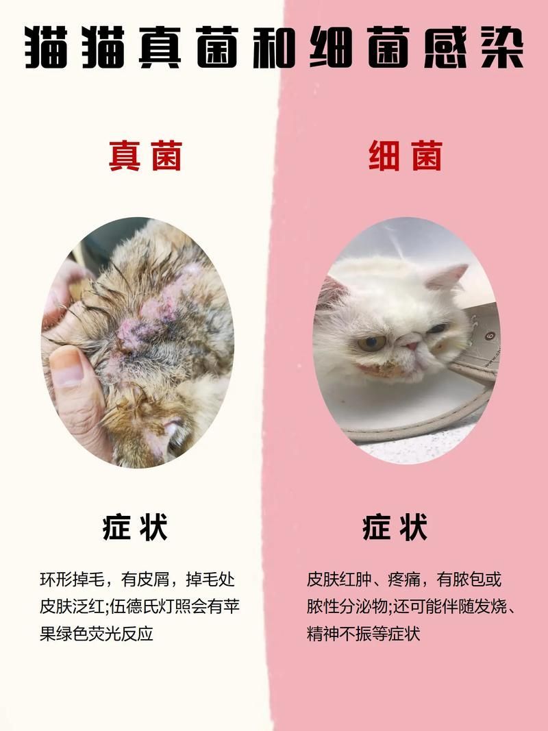 能否提供真菌和細菌感染的對比圖，如何區別真菌和細菌感染