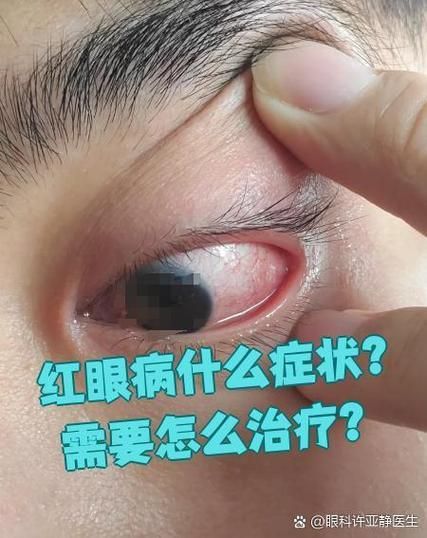 銀龍魚紅眼病的癥狀有哪些？，關(guān)于銀龍魚紅眼病