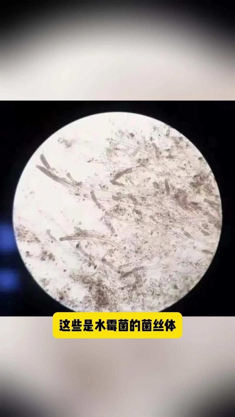 如何區(qū)分魚類真菌和細菌感染，如何區(qū)分魚類真菌感染與細菌感染 如何區(qū)分魚類真菌和細菌感染，如何區(qū)分魚類真菌感染與細菌感染 龍魚百科 第3張