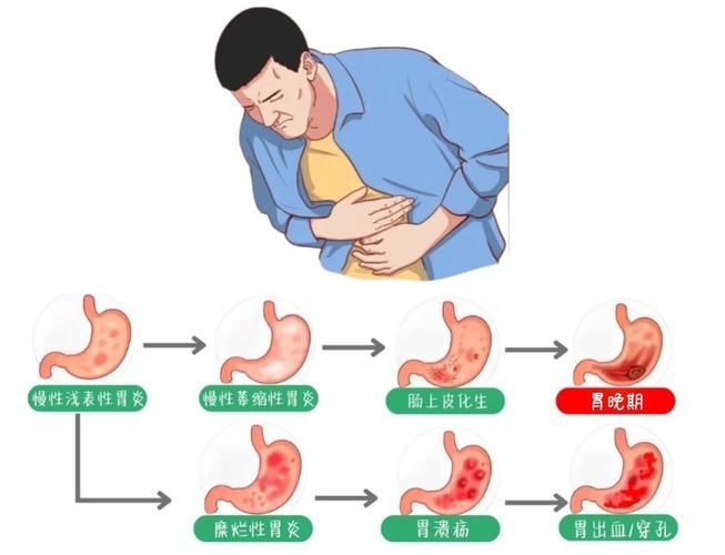 能再詳細(xì)分析幾個(gè)拒食原因嗎，厭深入探討拒食現(xiàn)象