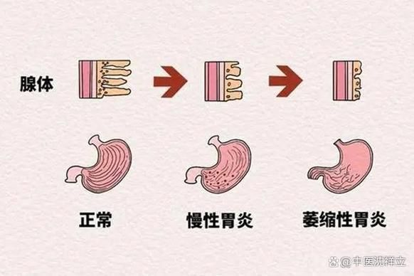 能再詳細(xì)分析幾個(gè)拒食原因嗎，厭深入探討拒食現(xiàn)象