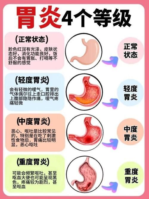 能再詳細(xì)分析幾個(gè)拒食原因嗎，厭深入探討拒食現(xiàn)象