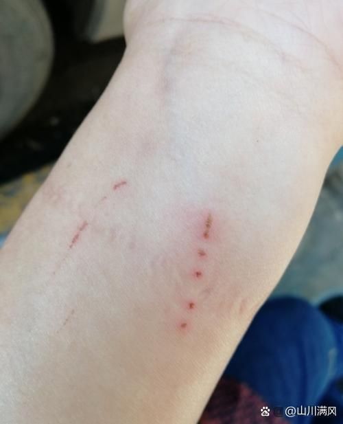 被龍魚咬傷后需要多久恢復，被龍魚咬傷后多久可以洗澡