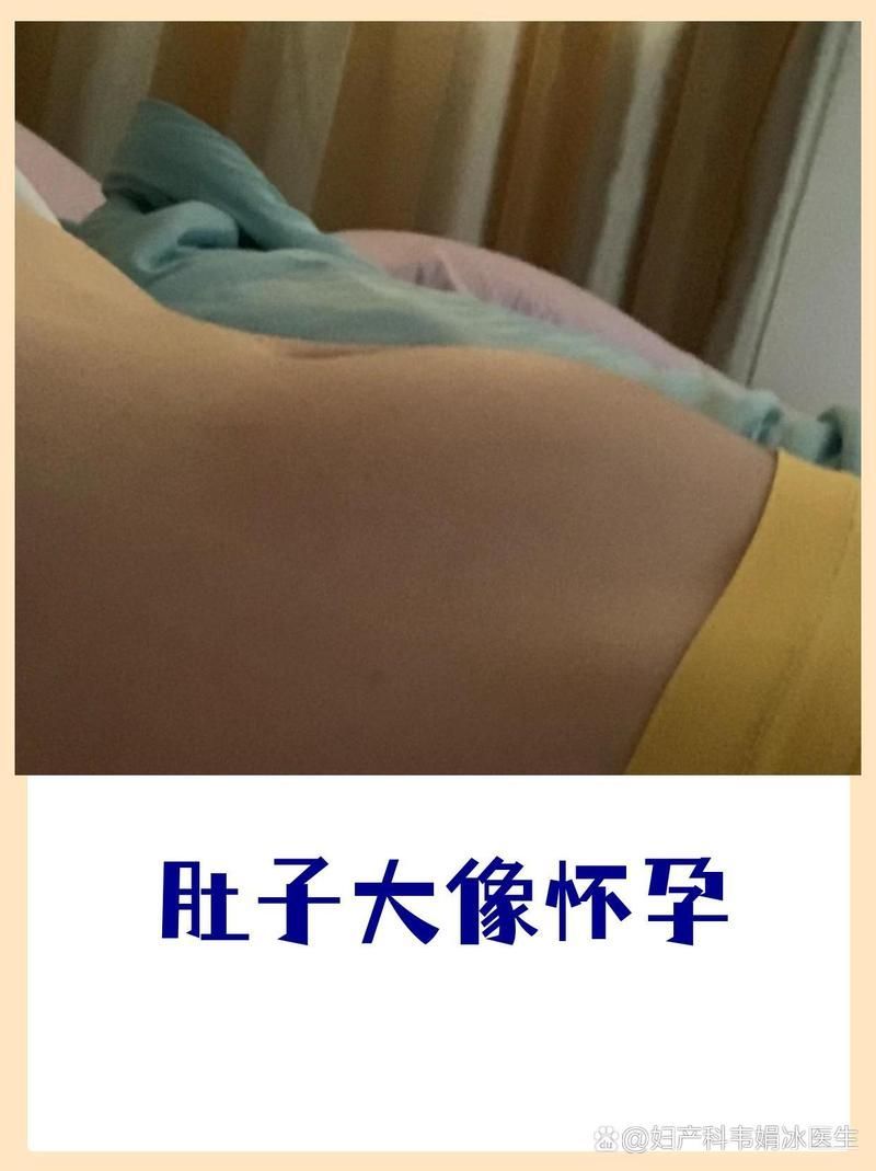 如何判斷大肚子病是否自愈，“大肚子病”是否自愈的重要手段