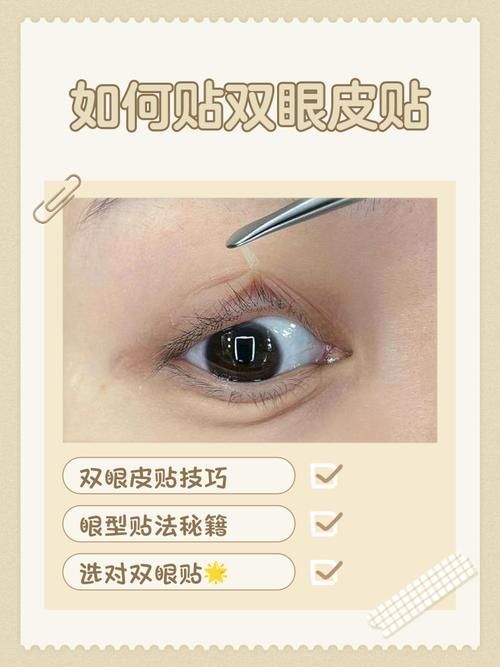 如何預(yù)防蒙眼病復(fù)發(fā)，眼病復(fù)發(fā)的預(yù)防措施