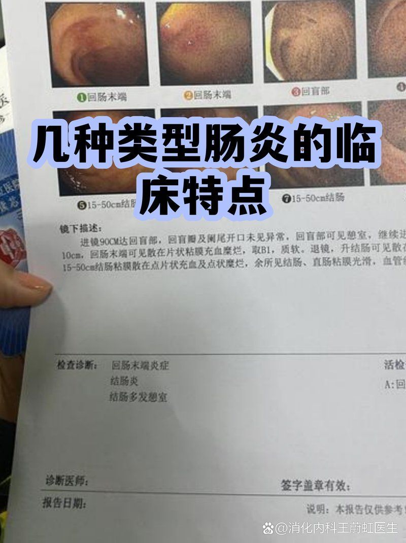 如何區分內寄和腸炎，內寄和腸炎哪個更嚴重