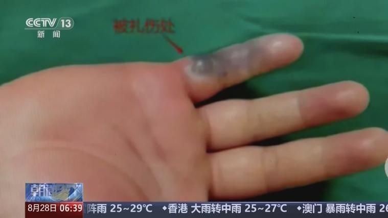 有哪些預防海里細菌感染的方法，富媒體組件預防海里細菌感染 有哪些預防海里細菌感染的方法，富媒體組件預防海里細菌感染 龍魚百科 第6張