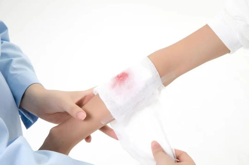 如何正確使用酒精和碘伏消毒，arxiv論文酒精和碘伏消毒、碘伏消毒、碘伏消毒