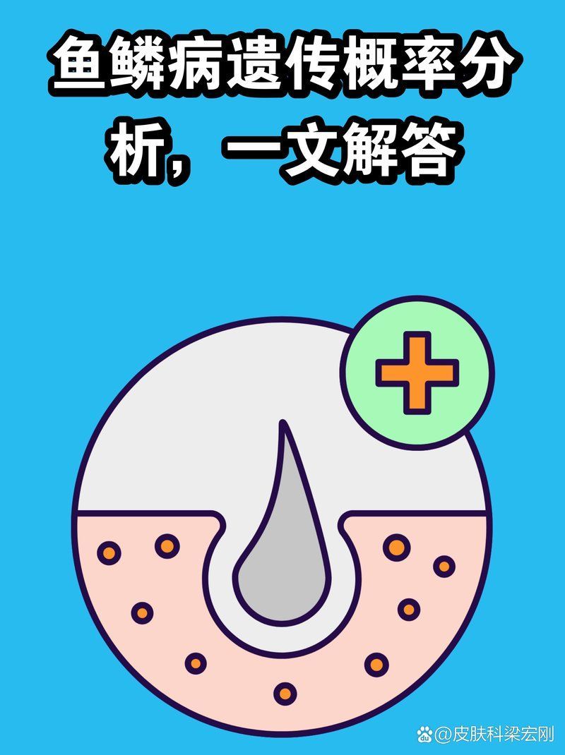 魚鱗病能否遺傳給下一代，魚鱗病會遺傳給下一代嗎？