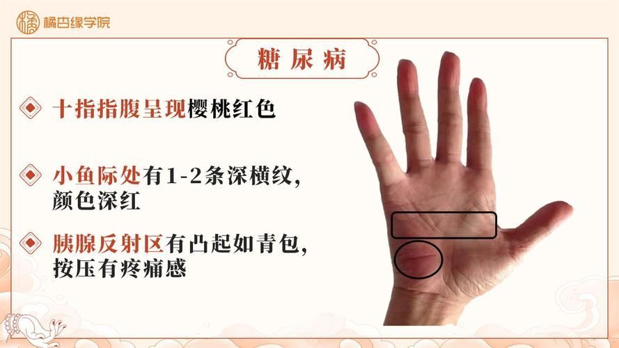 如何判斷自己是否患有這三種病，如何判斷自己是否患有“這三種病”