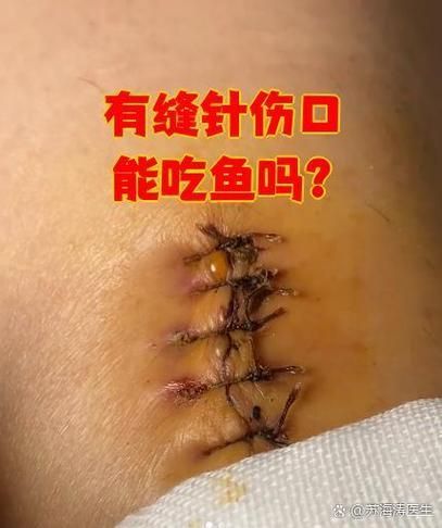 手術切除肉球后如何護理龍魚？，手術切除龍魚肉球后潰爛、脂肪瘤或增生組織護理需求