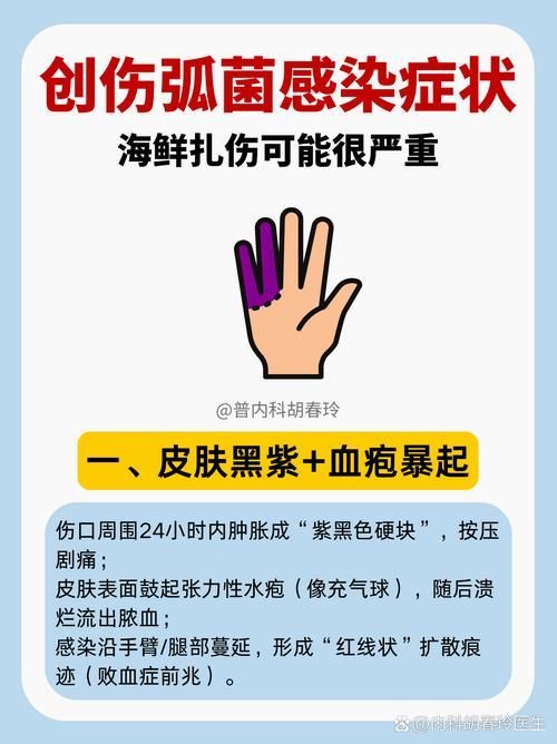 如何預防海水細菌感染，海水病原體防控