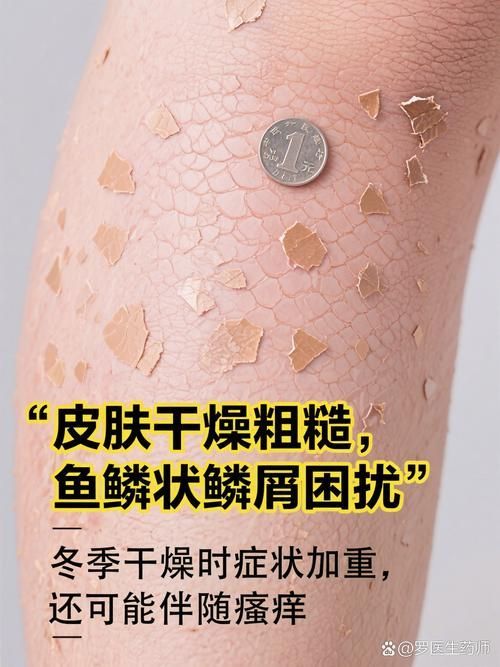 魚鱗皮膚病圖片，如何區分不同類型的魚鱗病？