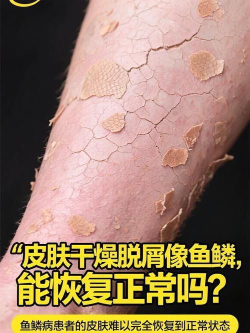 魚鱗皮膚病圖片，如何區分不同類型的魚鱗病？