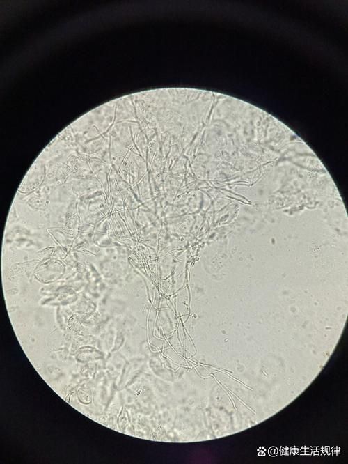 如何判斷銀龍魚潰爛是否繼發(fā)水霉菌感染，如何判斷銀龍魚是否潰爛