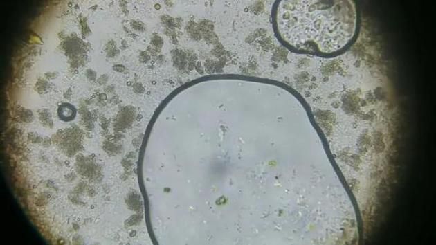 如何判斷銀龍魚潰爛是否繼發(fā)水霉菌感染，如何判斷銀龍魚是否潰爛