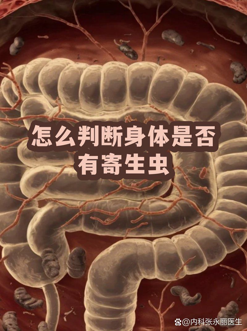 有哪些常見的寄生蟲感染案例，“蟲感亂”是什么？