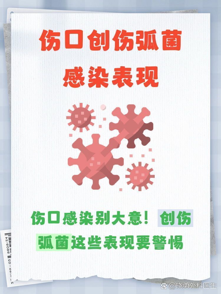 如何判斷自己是否感染了海洋創傷弧菌，——海洋創傷弧菌感染應該如何處理