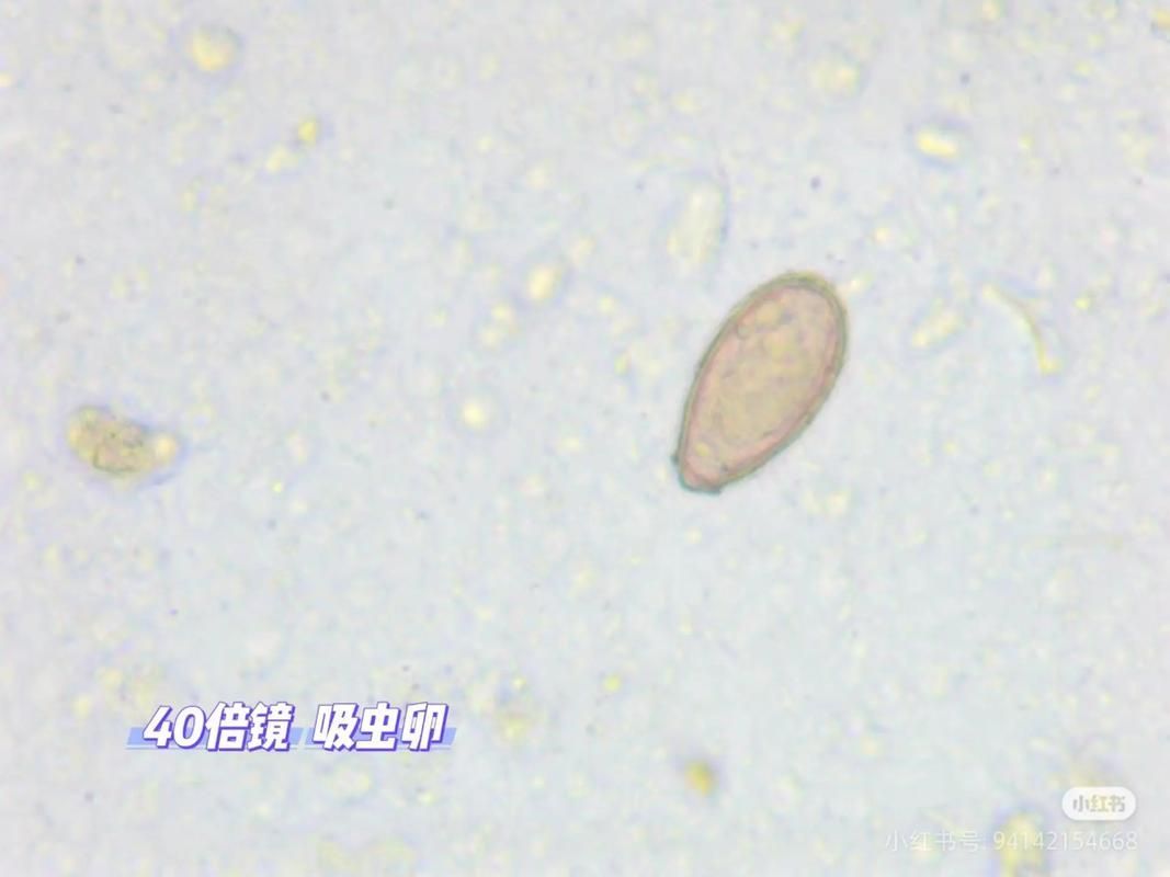 如何安全地食用魚類以避免寄生蟲感染，arxiv論文助手arxiv論文助手arxiv論文助手
