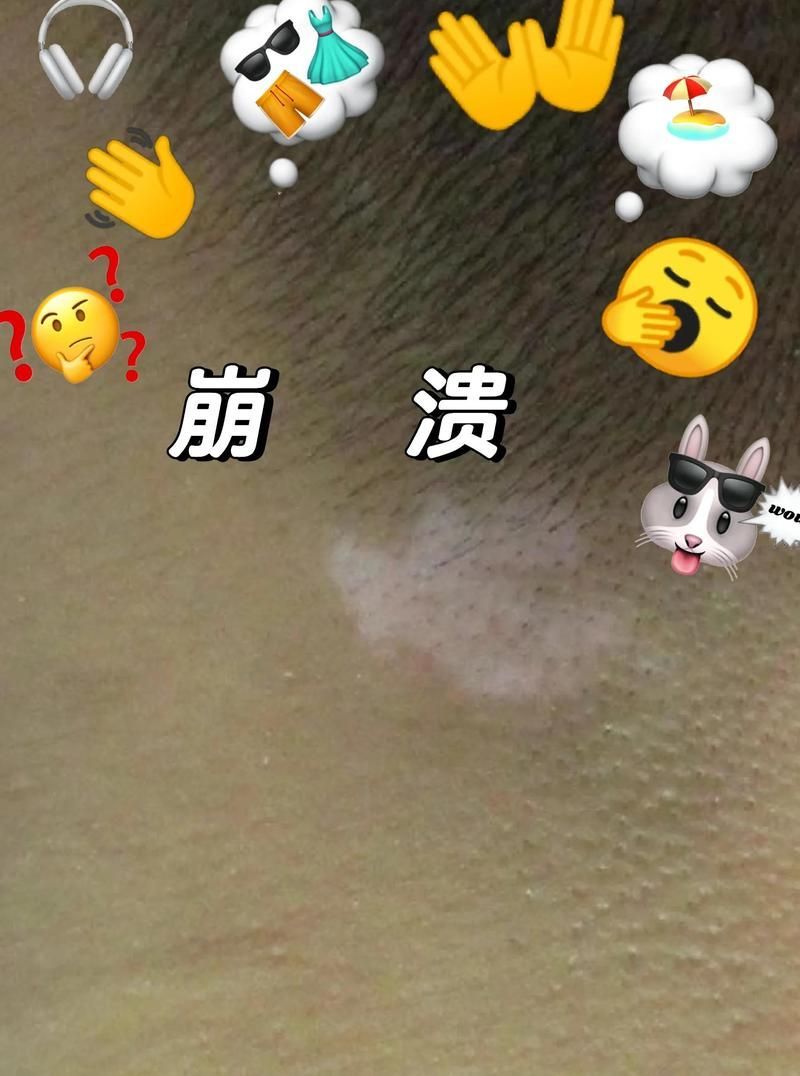 白點病治療期間需要忌口嗎，白點病治療期間多久見效，