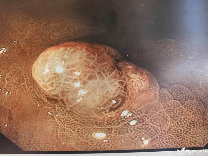 黃粉蟲對龍魚有哪些具體危害，粉蟲對龍魚的危害