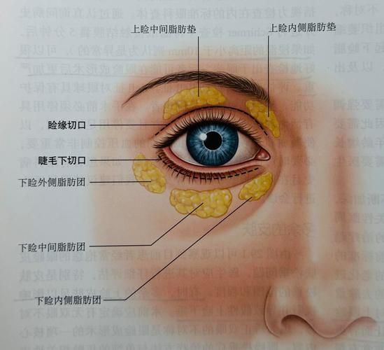有哪些藥物可以幫助治療魚突眼，“魚突眼”的藥物治療