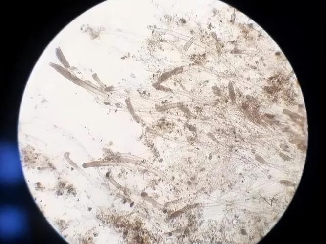 如何判斷魚缸是否感染真菌，arxiv論文助手arxiv論文助手判斷魚缸是否感染真菌