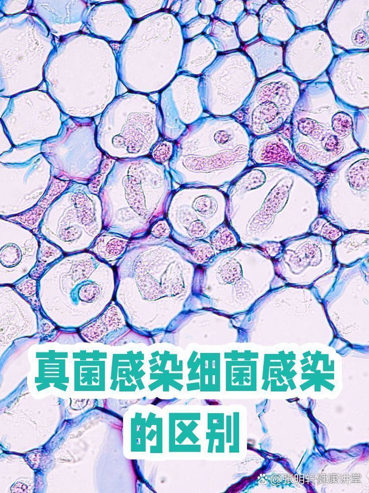 真菌感染和細菌感染如何區分，張明軒健康講堂張明軒健康講堂張明軒健康講堂張明軒