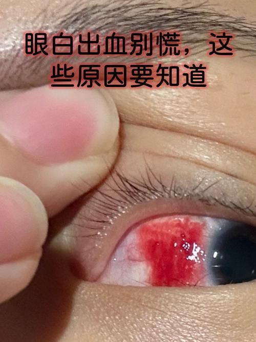 魚頭充血多久會好，“魚頭充血多久會好”