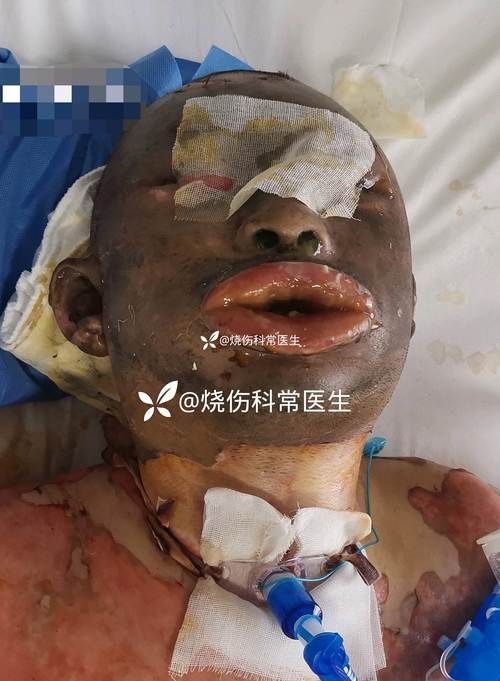 如何判斷銀龍魚嘴傷是否好轉？，如何判斷銀龍魚嘴傷