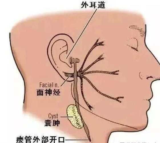 翻鰓手術風險大嗎，百度健康-去問診,