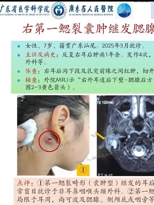 翻鰓手術風險大嗎，百度健康-去問診,