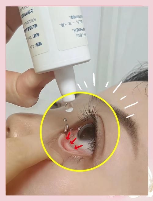 如何預(yù)防魚蒙眼病的復(fù)發(fā)，魚蒙眼病復(fù)發(fā)預(yù)防